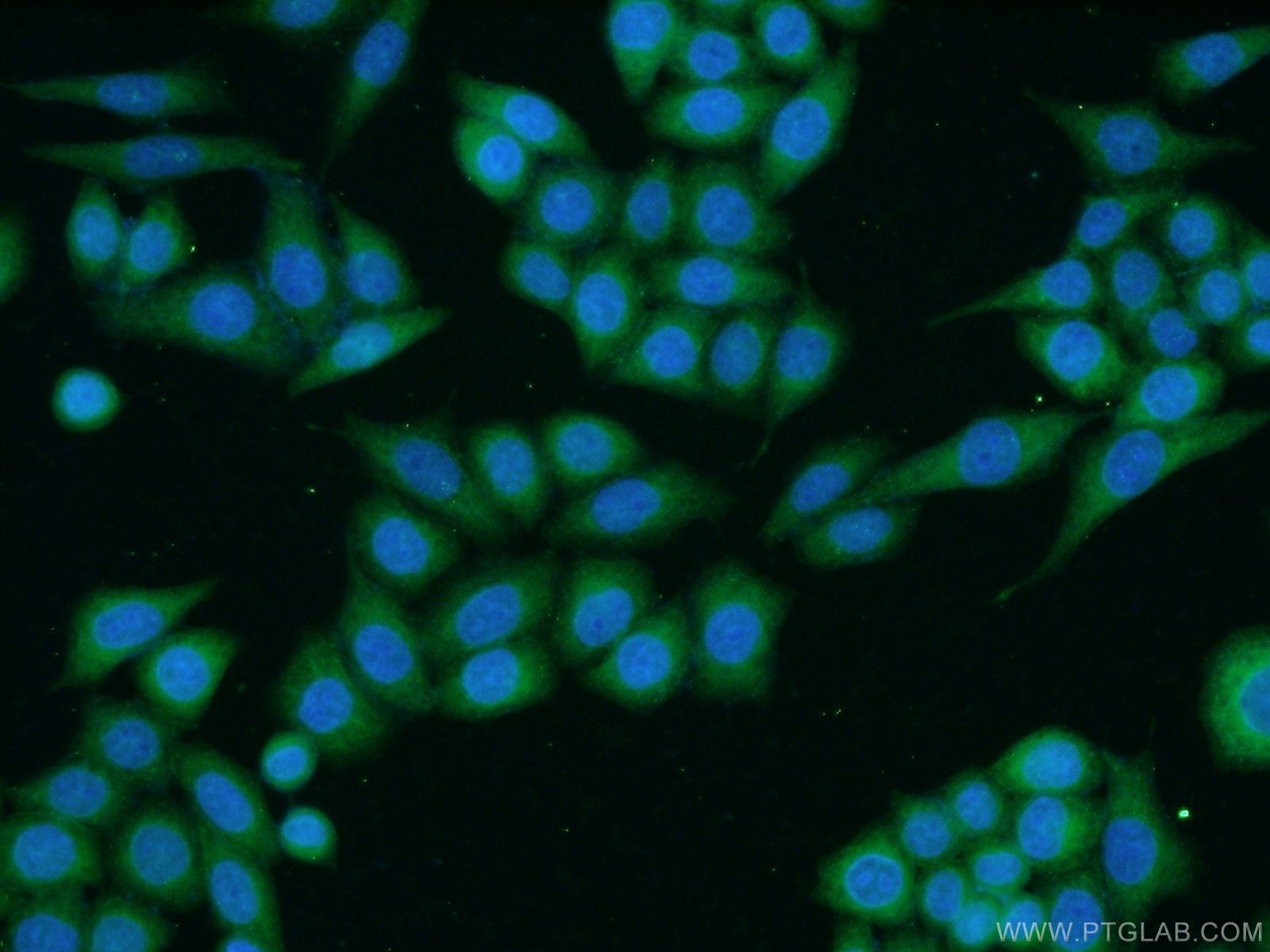 Immunofluorescence (IF) / fluorescent staining of HeLa cells using TACC1 Polyclonal antibody (13862-1-AP)