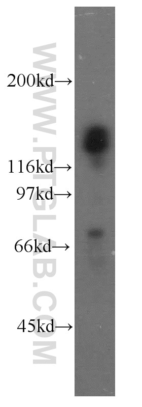 Western Blot (WB) analysis of HeLa cells using TACC1 Polyclonal antibody (13862-1-AP)