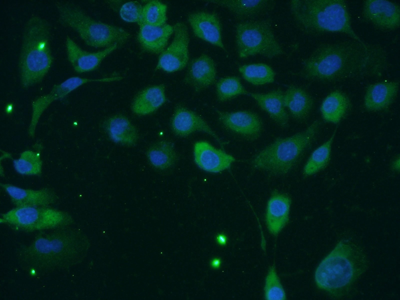 Immunofluorescence (IF) / fluorescent staining of A431 cells using TACC2 Polyclonal antibody (11407-1-AP)