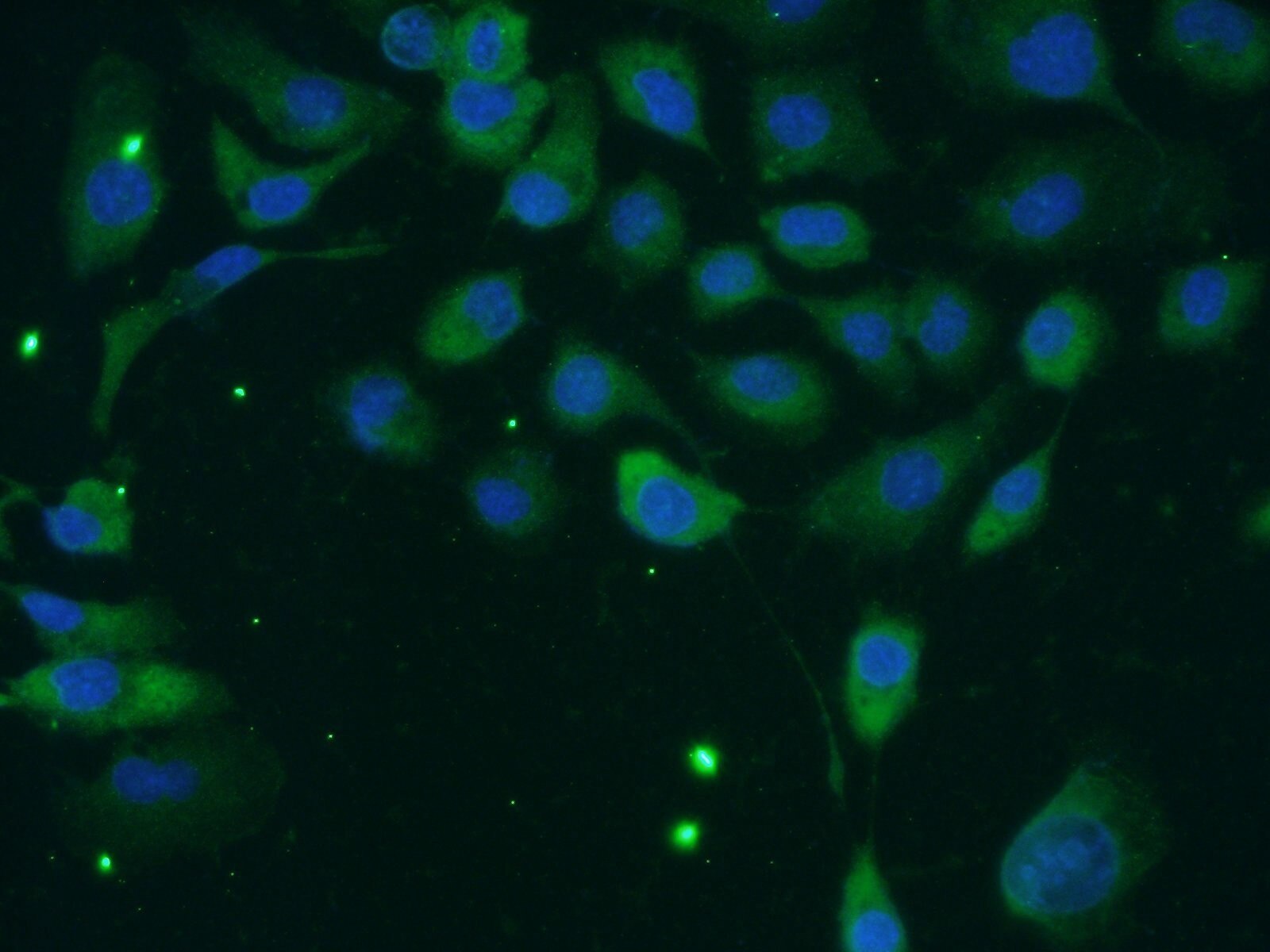 IF Staining of A431 using 11407-1-AP