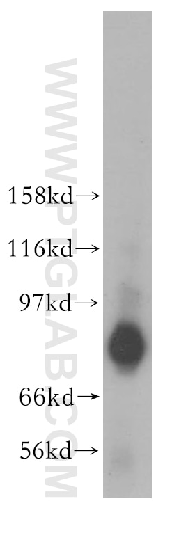 Western Blot (WB) analysis of mouse testis tissue using TACC2 Polyclonal antibody (11407-1-AP)
