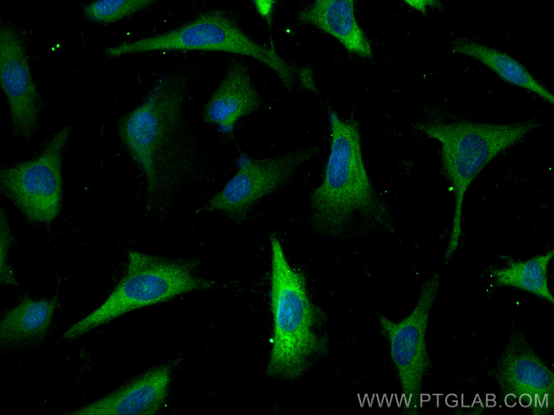 Immunofluorescence (IF) / fluorescent staining of HeLa cells using TACC3 Polyclonal antibody (25697-1-AP)