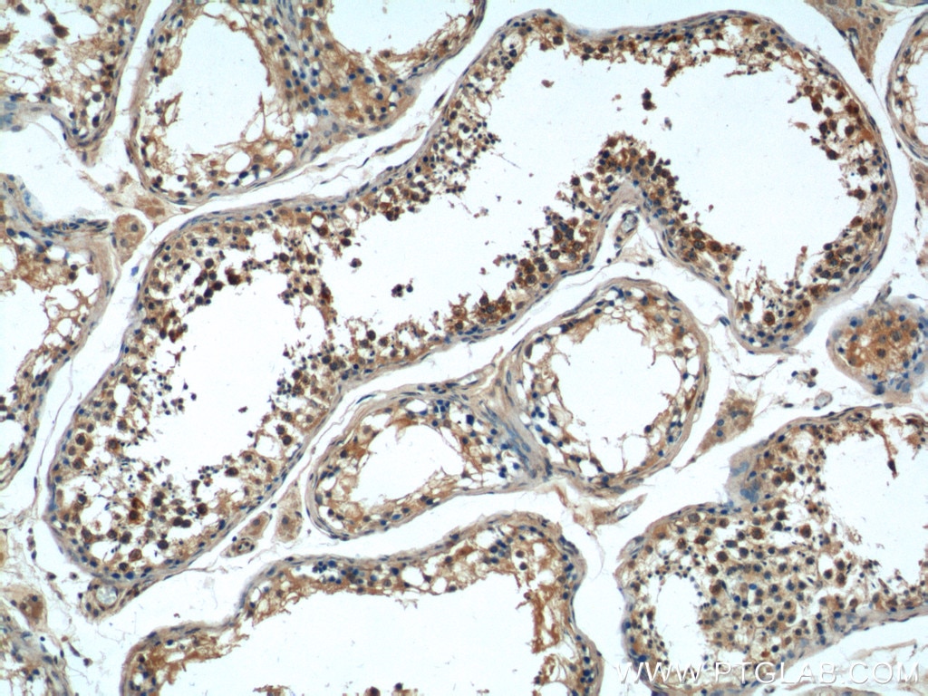 Immunohistochemistry (IHC) staining of human testis tissue using TACC3 Polyclonal antibody (25697-1-AP)