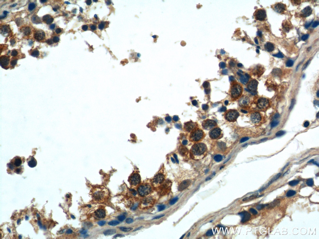Immunohistochemistry (IHC) staining of human testis tissue using TACC3 Polyclonal antibody (25697-1-AP)