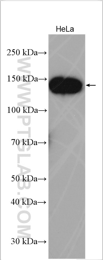 Western Blot (WB) analysis of various lysates using TACC3 Polyclonal antibody (25697-1-AP)