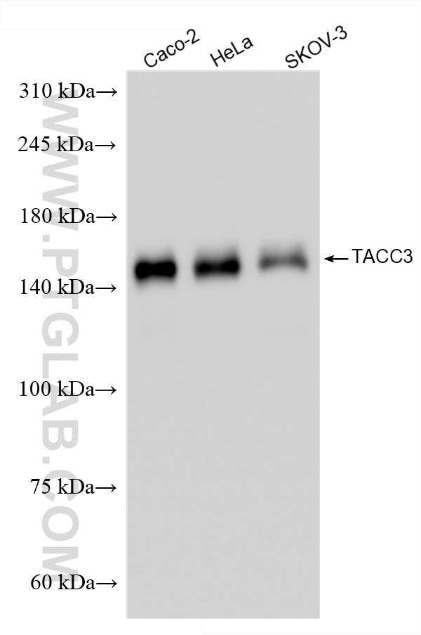 Western Blot (WB) analysis of various lysates using TACC3 Polyclonal antibody (25697-1-AP)