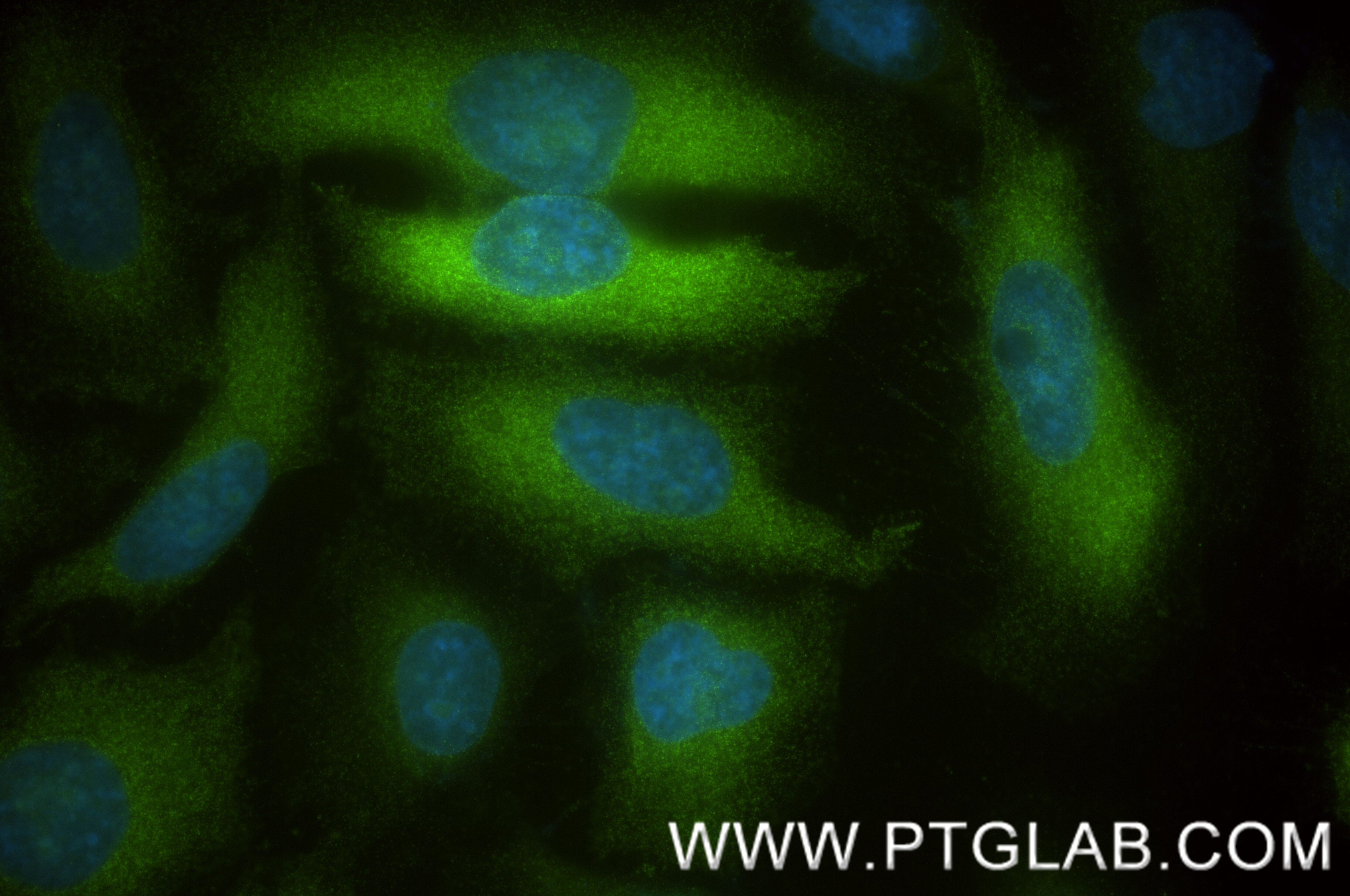 Immunofluorescent analysis of (-20°C Ethanol) fixed HeLa cells using TACC3 antibody (84940-5-RR, Clone: 242527A12 ) at dilution of 1:400 and CoraLite®488-Conjugated Goat Anti-Rabbit IgG(H+L) (SA00013-2). Immunofluorescence (IF) / fluorescent staining of HeLa cells using TACC3 Recombinant antibody (84940-5-RR)