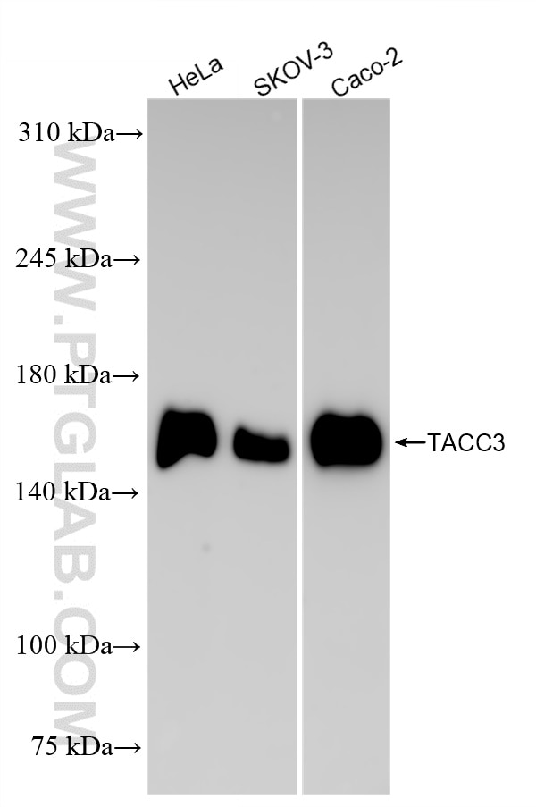 Western Blot (WB) analysis of various lysates using TACC3 Recombinant antibody (84940-5-RR)