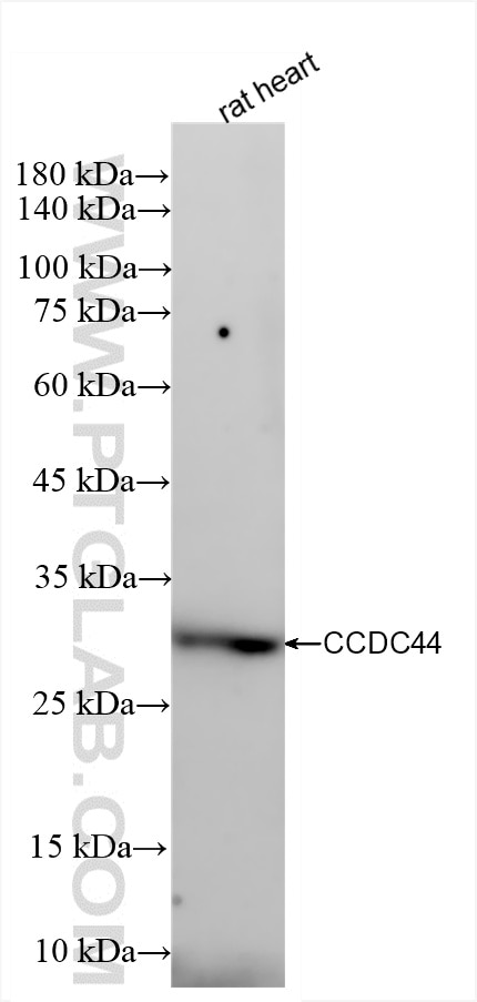 TACO1/CCDC44