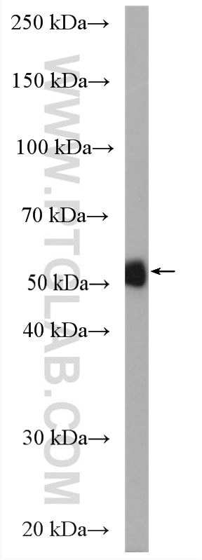 Western Blot (WB) analysis of THP-1 cells using Neurokinin-1 receptor Polyclonal antibody (17942-1-AP)