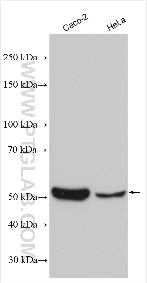 Western Blot (WB) analysis of various lysates using Neurokinin-1 receptor Polyclonal antibody (17942-1-AP)