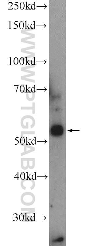 Western Blot (WB) analysis of mouse pancreas tissue using Neurokinin-1 receptor Polyclonal antibody (17942-1-AP)