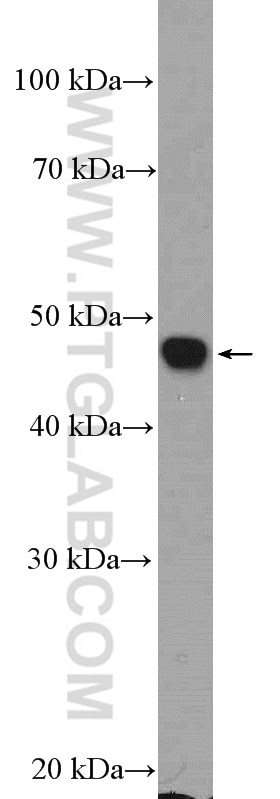 WB analysis of SH-SY5Y using 17942-1-AP