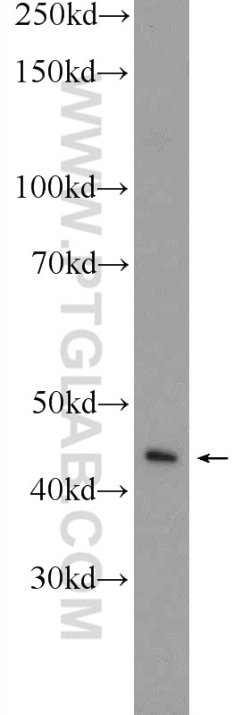 Western Blot (WB) analysis of HeLa cells using TACR2 Polyclonal antibody (25270-1-AP)