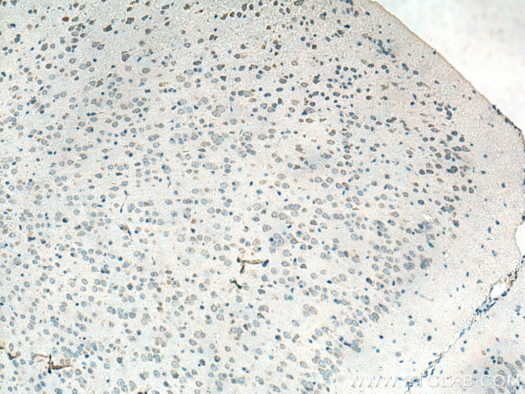 Immunohistochemistry (IHC) staining of mouse brain tissue using TACR3 Polyclonal antibody (22334-1-AP)