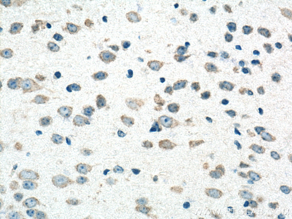 Immunohistochemistry (IHC) staining of mouse brain tissue using TACR3 Polyclonal antibody (22334-1-AP)