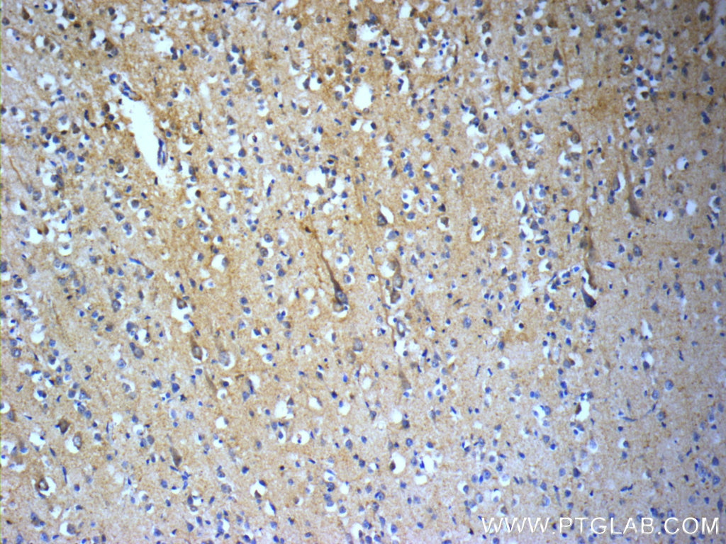 Immunohistochemistry (IHC) staining of human brain tissue using TACR3 Polyclonal antibody (22334-1-AP)