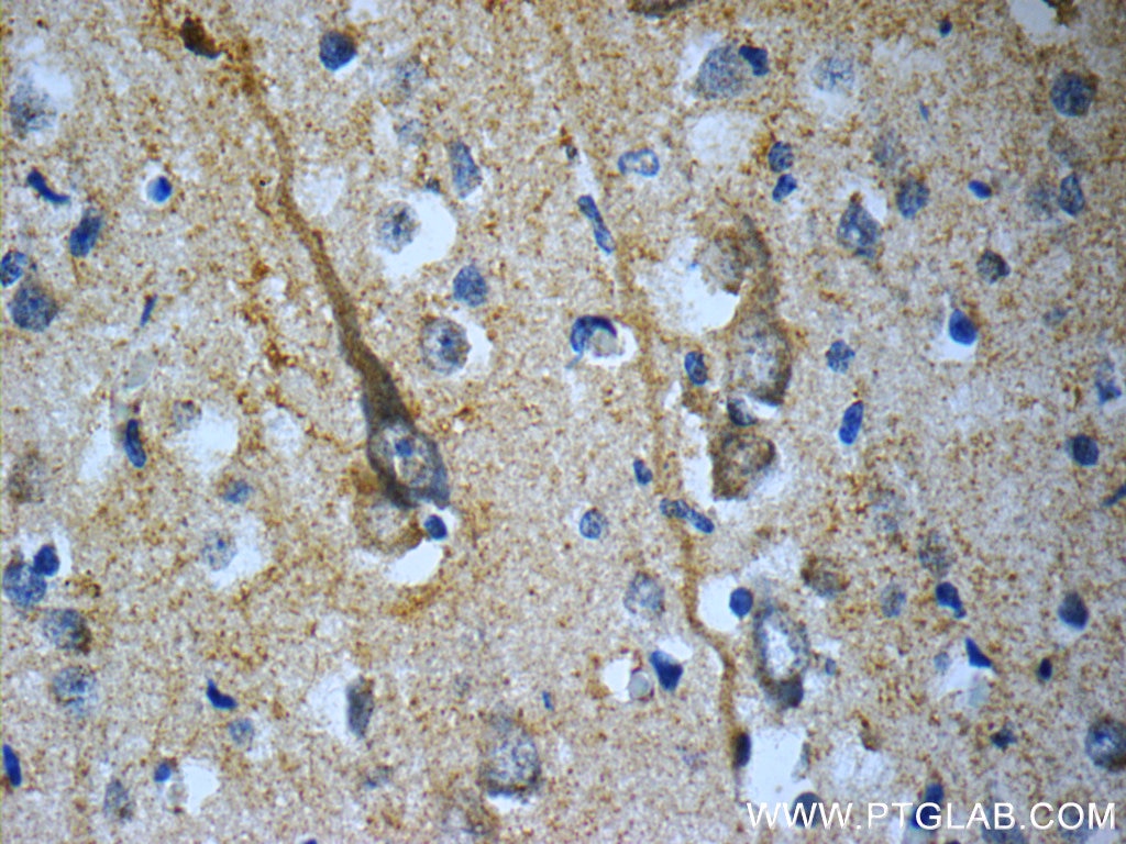 Immunohistochemistry (IHC) staining of human brain tissue using TACR3 Polyclonal antibody (22334-1-AP)