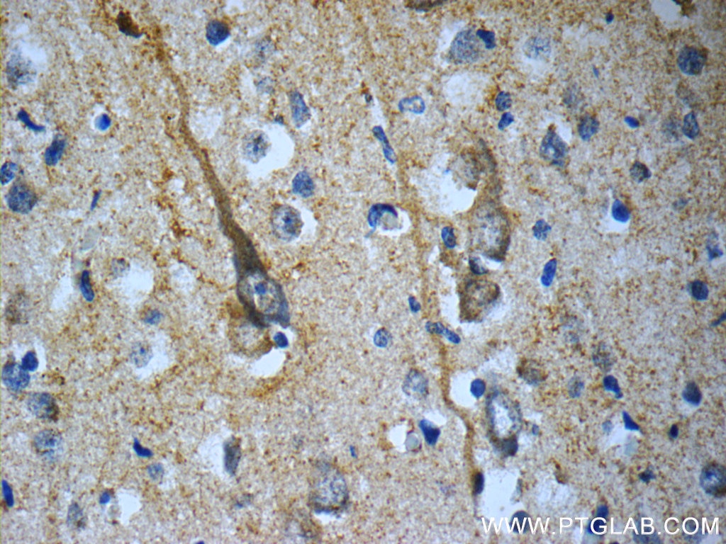 TACR3 Polyclonal antibody