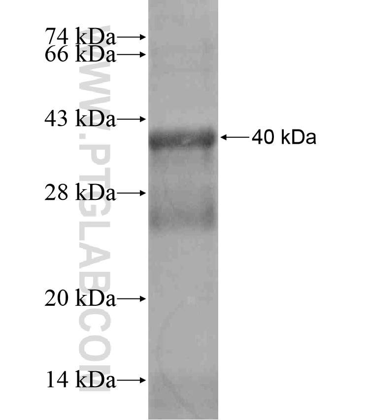 TACR3 fusion protein Ag17808 SDS-PAGE