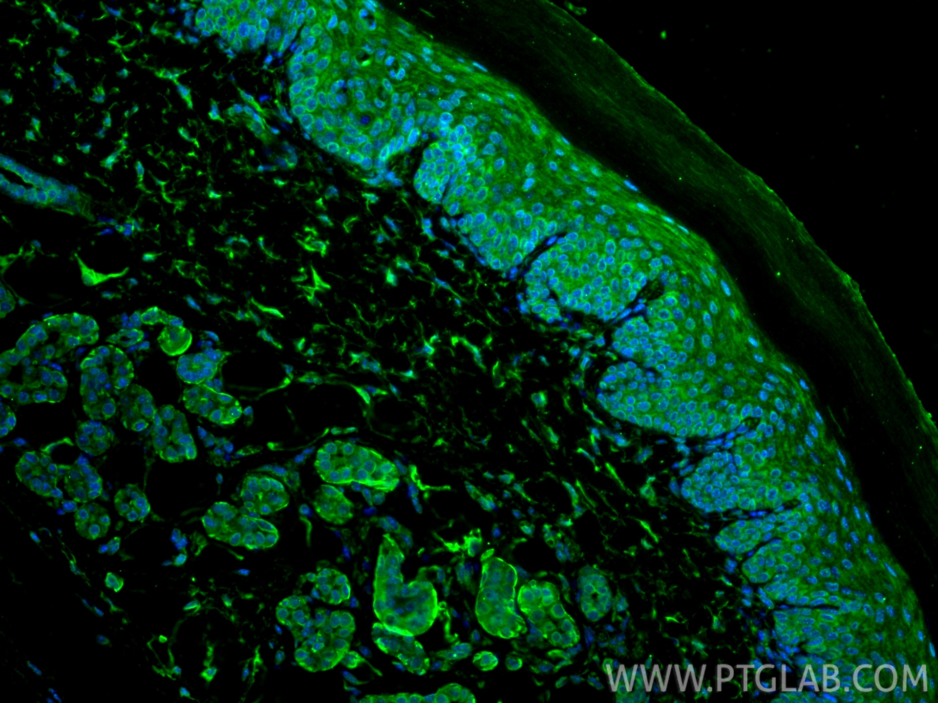 Immunofluorescence (IF) / fluorescent staining of mouse skin tissue using TACSTD2/TROP2 Monoclonal antibody (68141-1-Ig)
