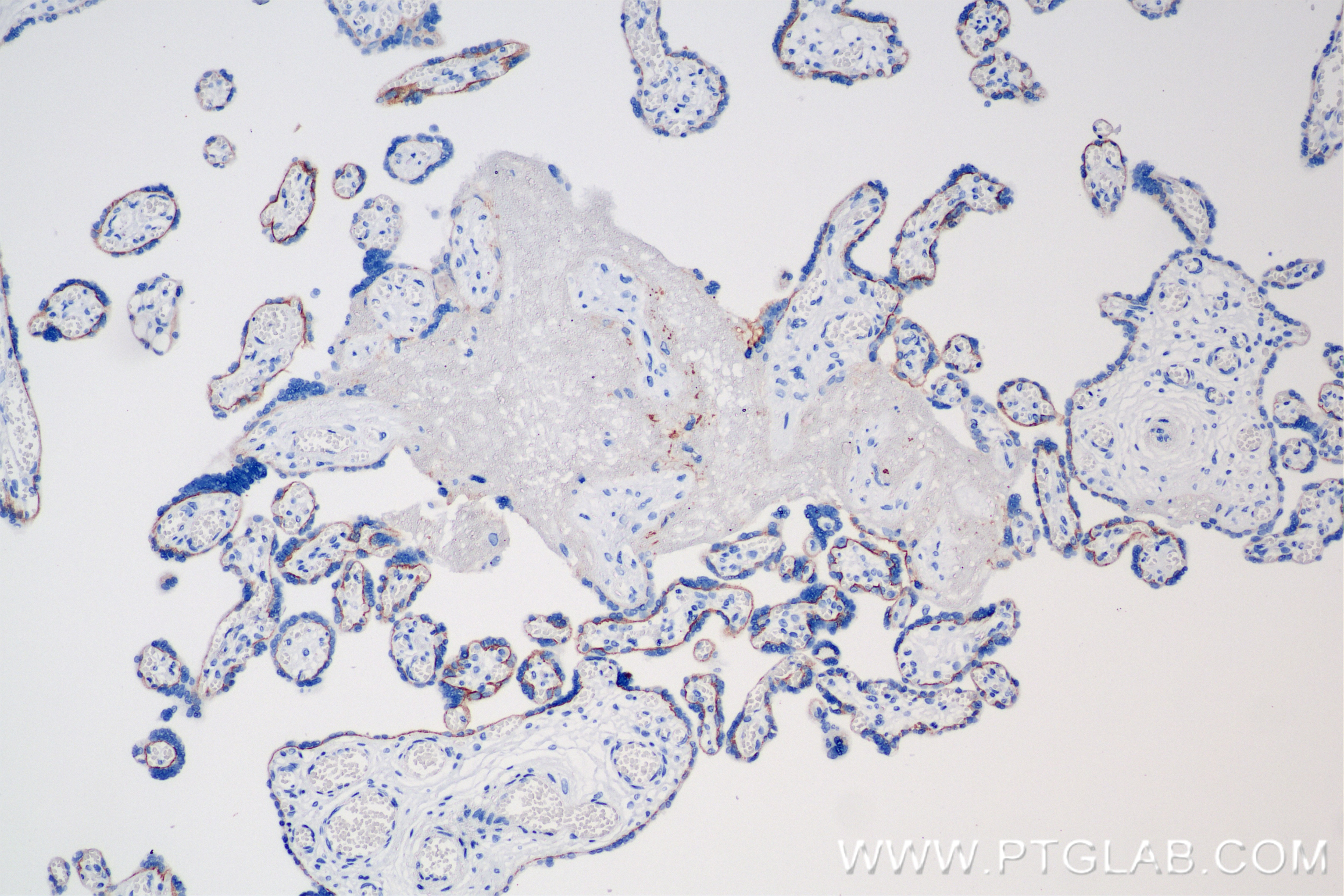 Immunohistochemical analysis of paraffin-embedded human placenta tissue slide using 86155-1-RR (TACSTD2/TROP2 antibody) at dilution of 1:1000 (under 10x lens). Heat mediated antigen retrieval with Tris-EDTA buffer (pH 9.0). Immunohistochemistry (IHC) staining of human placenta tissue using TACSTD2/TROP2 Recombinant antibody (86155-1-RR)