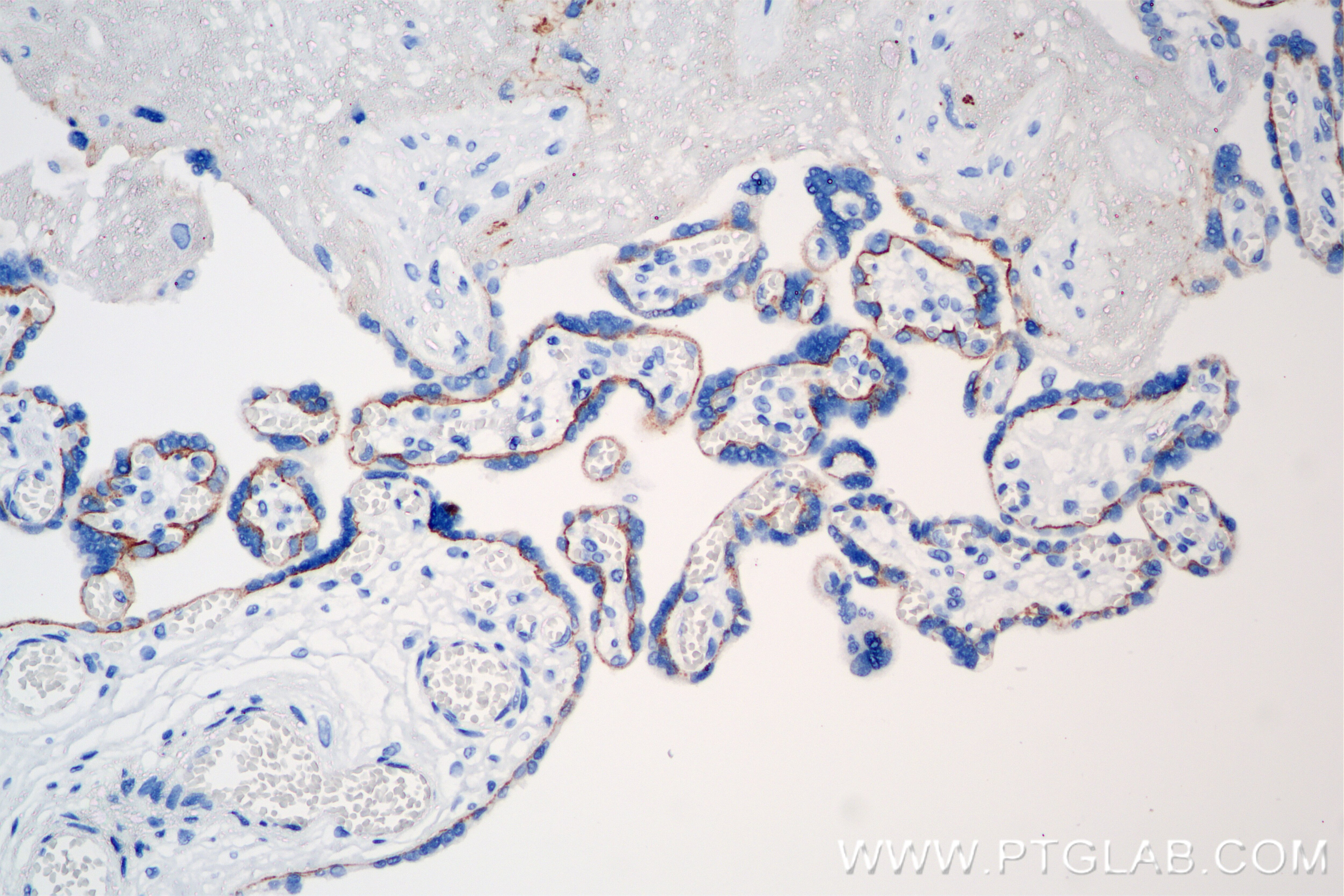 Immunohistochemical analysis of paraffin-embedded human placenta tissue slide using 86155-1-RR (TACSTD2/TROP2 antibody) at dilution of 1:1000 (under 20x lens). Heat mediated antigen retrieval with Tris-EDTA buffer (pH 9.0). Immunohistochemistry (IHC) staining of human placenta tissue using TACSTD2/TROP2 Recombinant antibody (86155-1-RR)