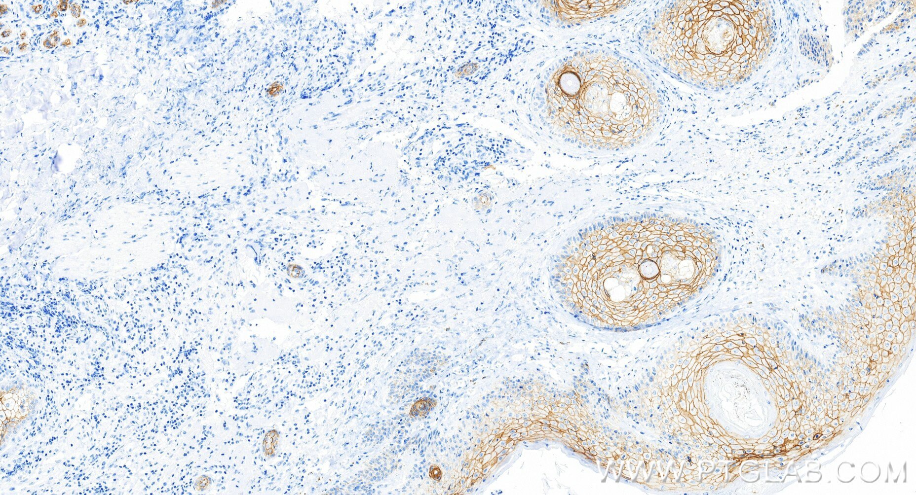 Immunohistochemistry (IHC) staining of human skin tissue using TACSTD2/TROP2 Recombinant monoclonal antibody (86155-1-RR)