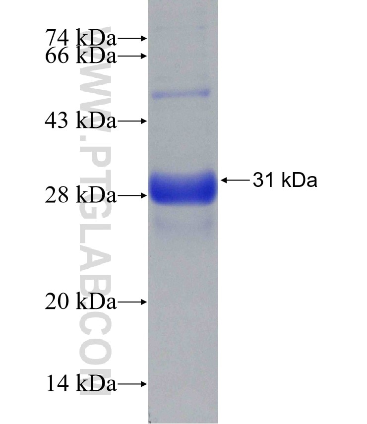 TACSTD2 fusion protein Ag31473 SDS-PAGE
