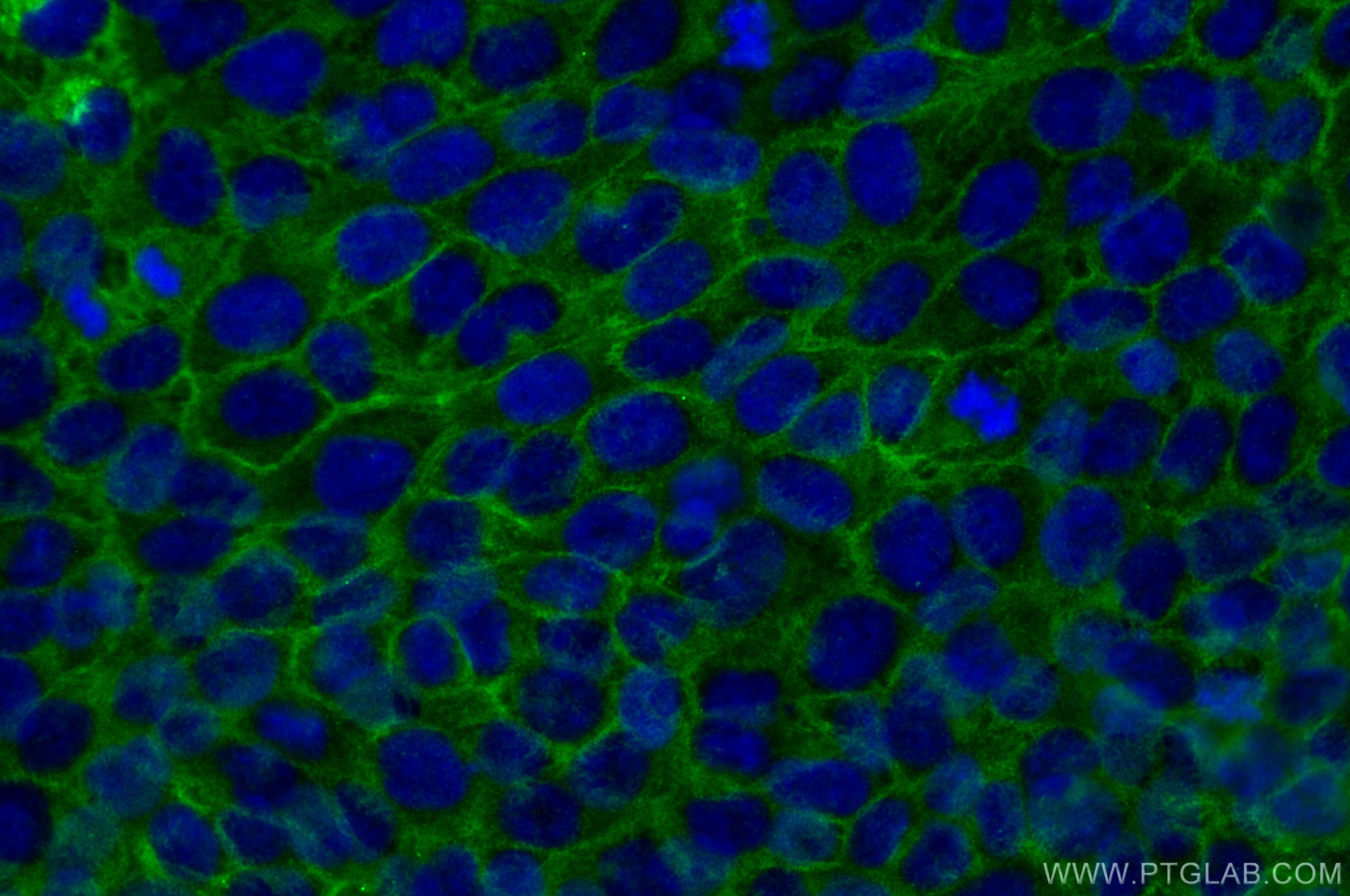 Immunofluorescence (IF) / fluorescent staining of HaCaT cells using TACSTD2/TROP2 Polyclonal antibody (29856-1-AP)