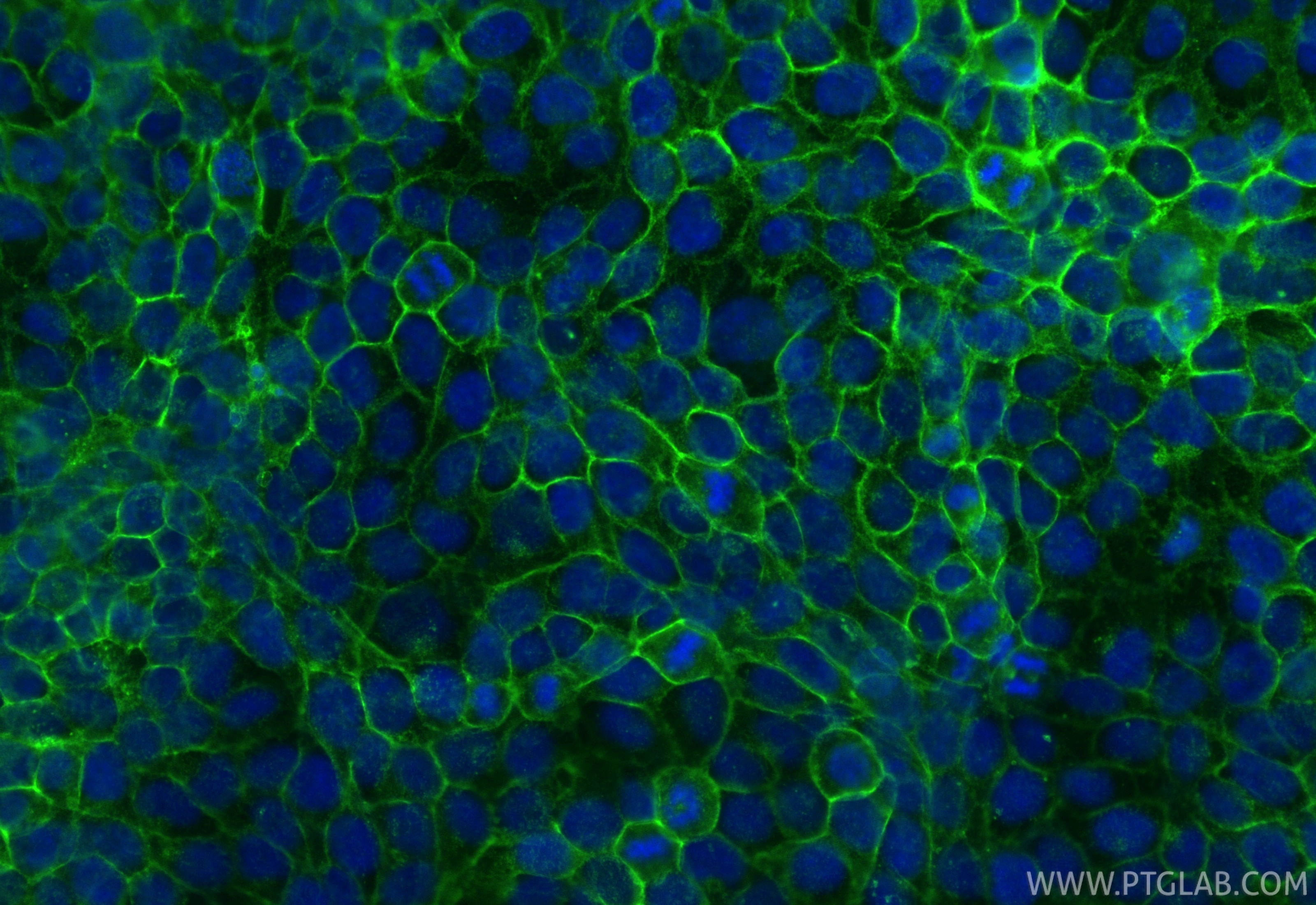 Immunofluorescence (IF) / fluorescent staining of HaCaT cells using CoraLite® Plus 488-conjugated TACSTD2/TROP2 Recomb (CL488-86155)
