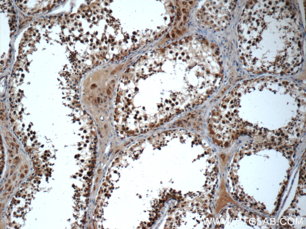 Immunohistochemistry (IHC) staining of human testis tissue using TADA1L Polyclonal antibody (20337-1-AP)