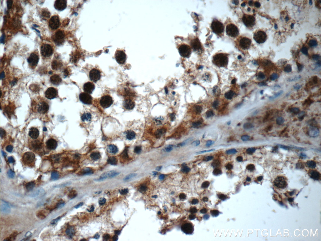 Immunohistochemistry (IHC) staining of human testis tissue using TADA1L Polyclonal antibody (20337-1-AP)