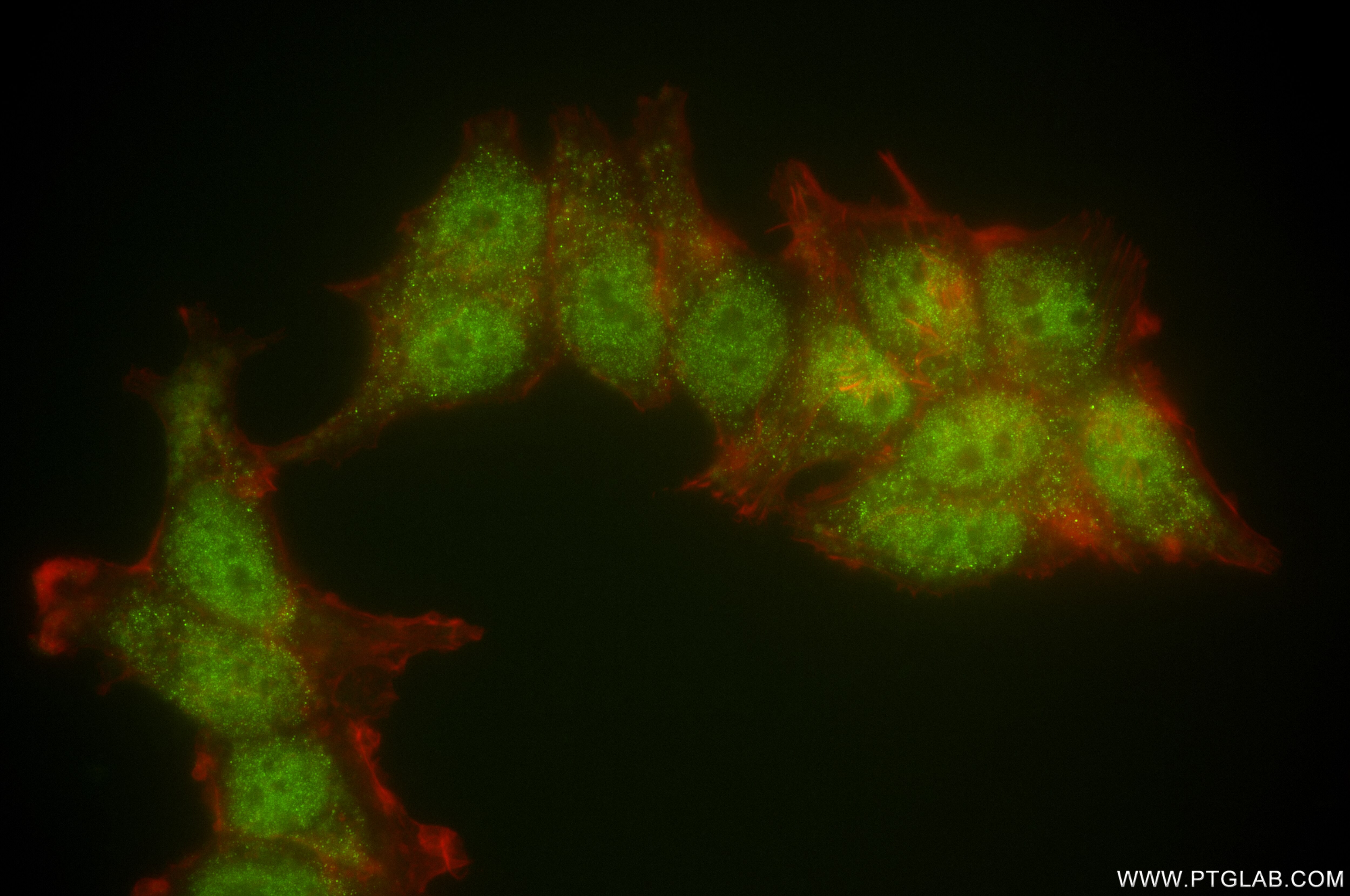 Immunofluorescence (IF) / fluorescent staining of MCF-7 cells using TADA1L Recombinant antibody (83641-4-RR)