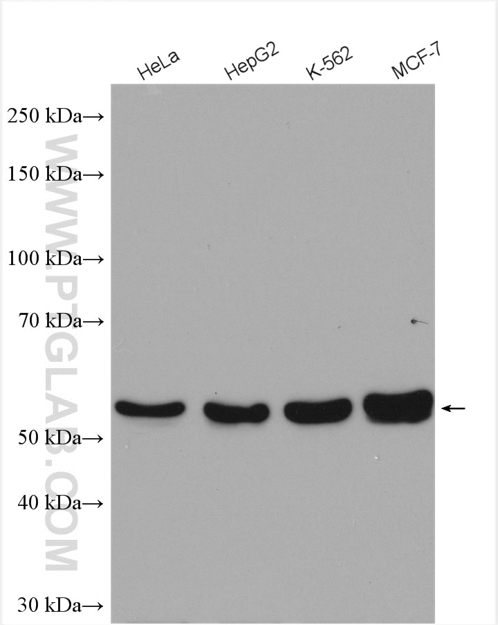 Western Blot (WB) analysis of various lysates using TADA2B Polyclonal antibody (17367-1-AP)