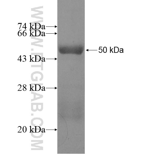 TADA2B fusion protein Ag10783 SDS-PAGE