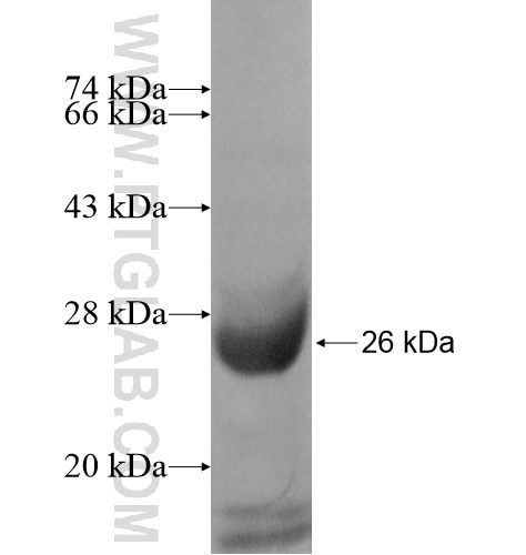TADA2B fusion protein Ag11628 SDS-PAGE