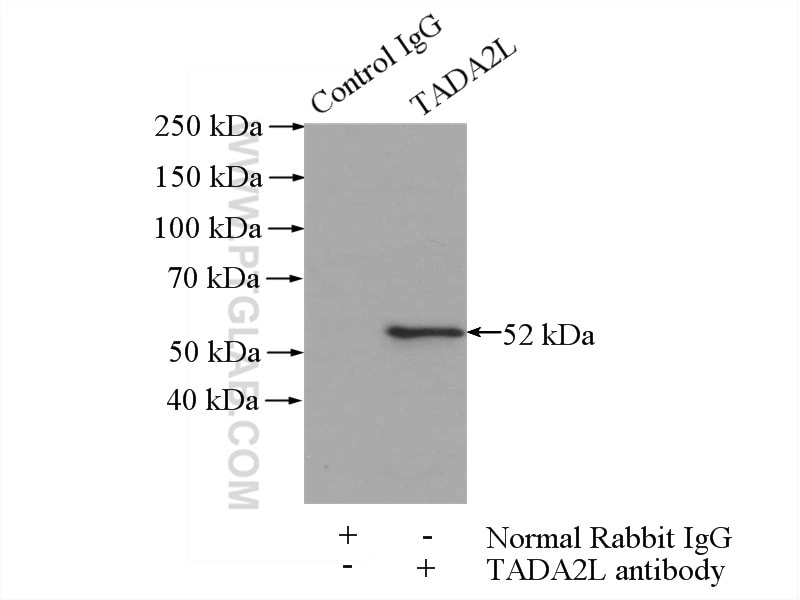 Immunoprecipitation (IP) experiment of mouse testis tissue using TADA2L Polyclonal antibody (11299-1-AP)