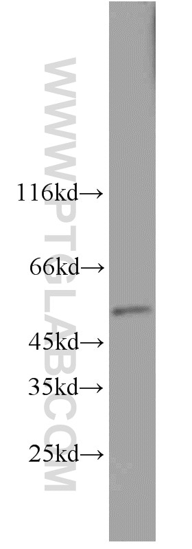 Western Blot (WB) analysis of NIH/3T3 cells using TADA3L Polyclonal antibody (10839-1-AP)