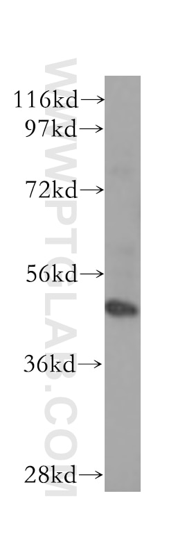 Western Blot (WB) analysis of human brain tissue using TADA3L Polyclonal antibody (10839-1-AP)