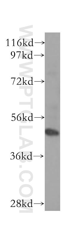 WB analysis of human brain using 10839-1-AP