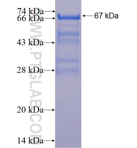 TADA3L fusion protein Ag1276 SDS-PAGE