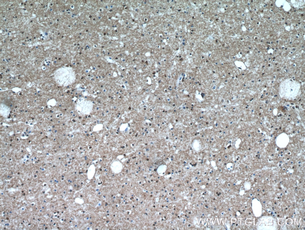 Immunohistochemistry (IHC) staining of human brain tissue using TAF1-Specific Polyclonal antibody (20260-1-AP)