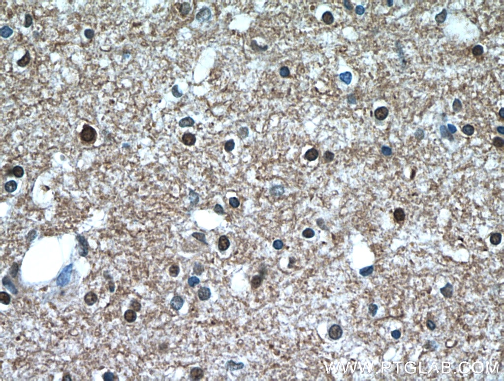 Immunohistochemistry (IHC) staining of human brain tissue using TAF1-Specific Polyclonal antibody (20260-1-AP)