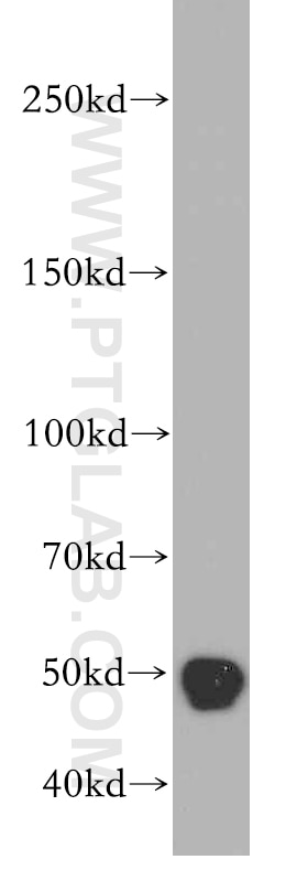 Western Blot (WB) analysis of mouse brain tissue using TAF1-Specific Polyclonal antibody (20260-1-AP)