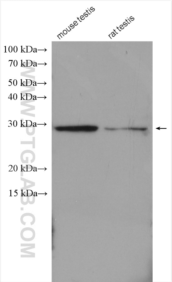 Western Blot (WB) analysis of mouse testis tissue using TAF10 Polyclonal antibody (20346-1-AP)