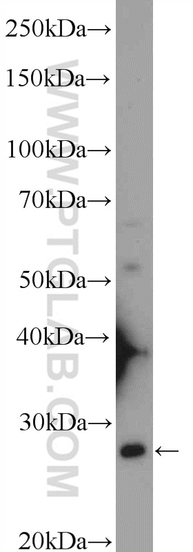 WB analysis of HeLa using 16114-1-AP