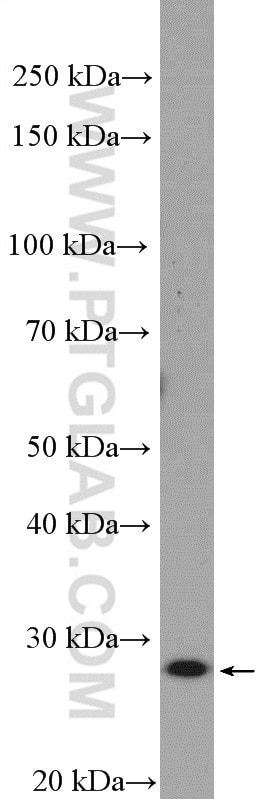 Western Blot (WB) analysis of HeLa cells using TAF11 Polyclonal antibody (16114-1-AP)