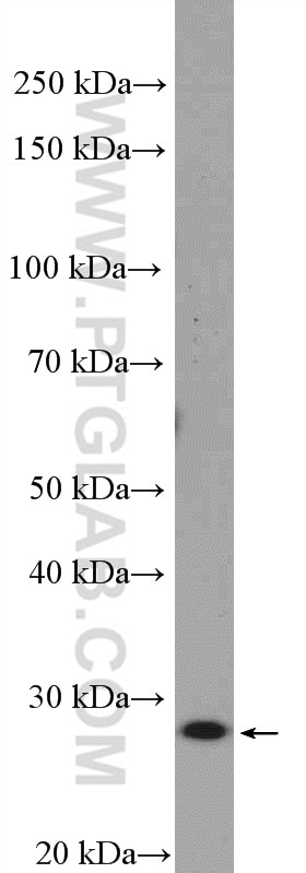 WB analysis of HeLa using 16114-1-AP