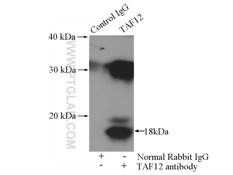 Immunoprecipitation (IP) experiment of Y79 cells using TAF12 Polyclonal antibody (12353-1-AP)